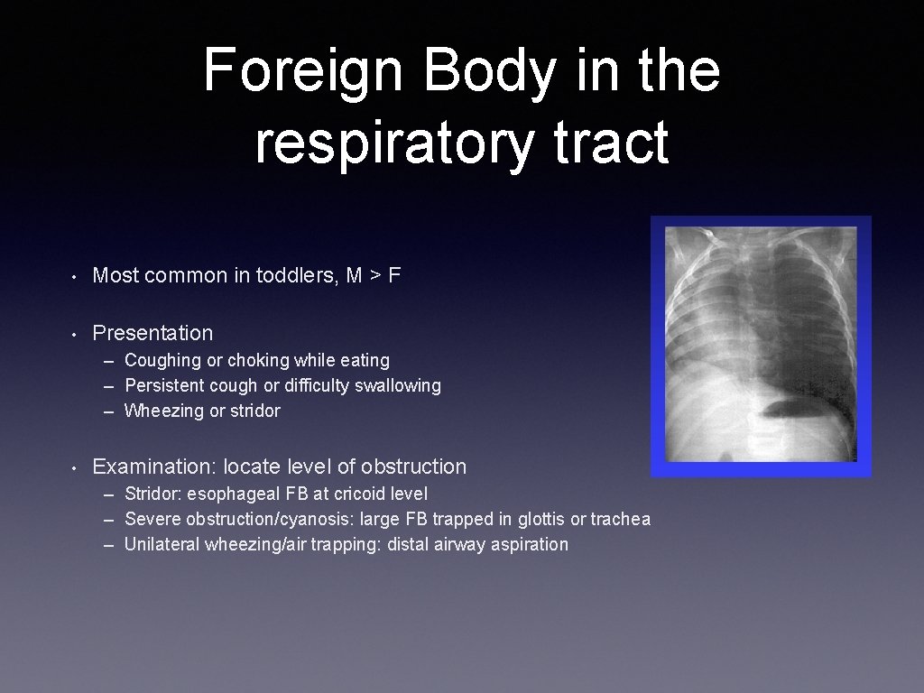 Foreign Body in the respiratory tract • Most common in toddlers, M > F