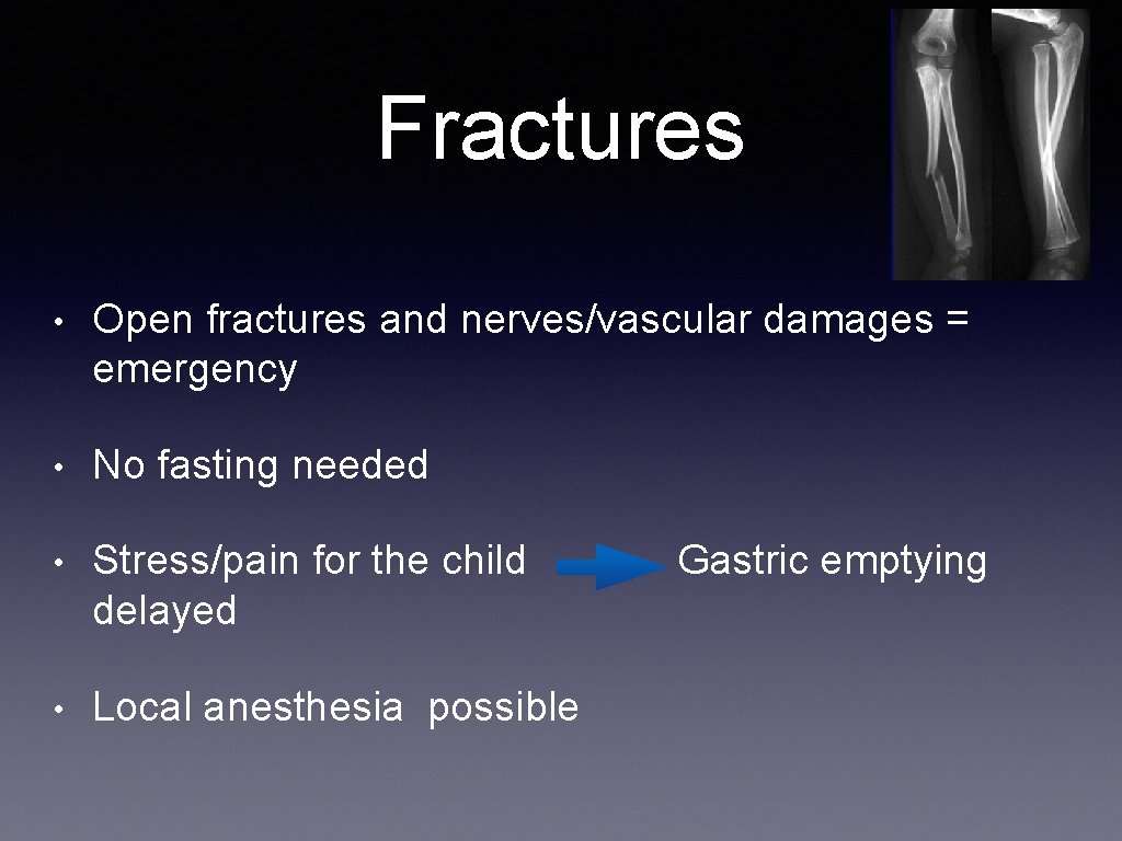 Fractures • Open fractures and nerves/vascular damages = emergency • No fasting needed •