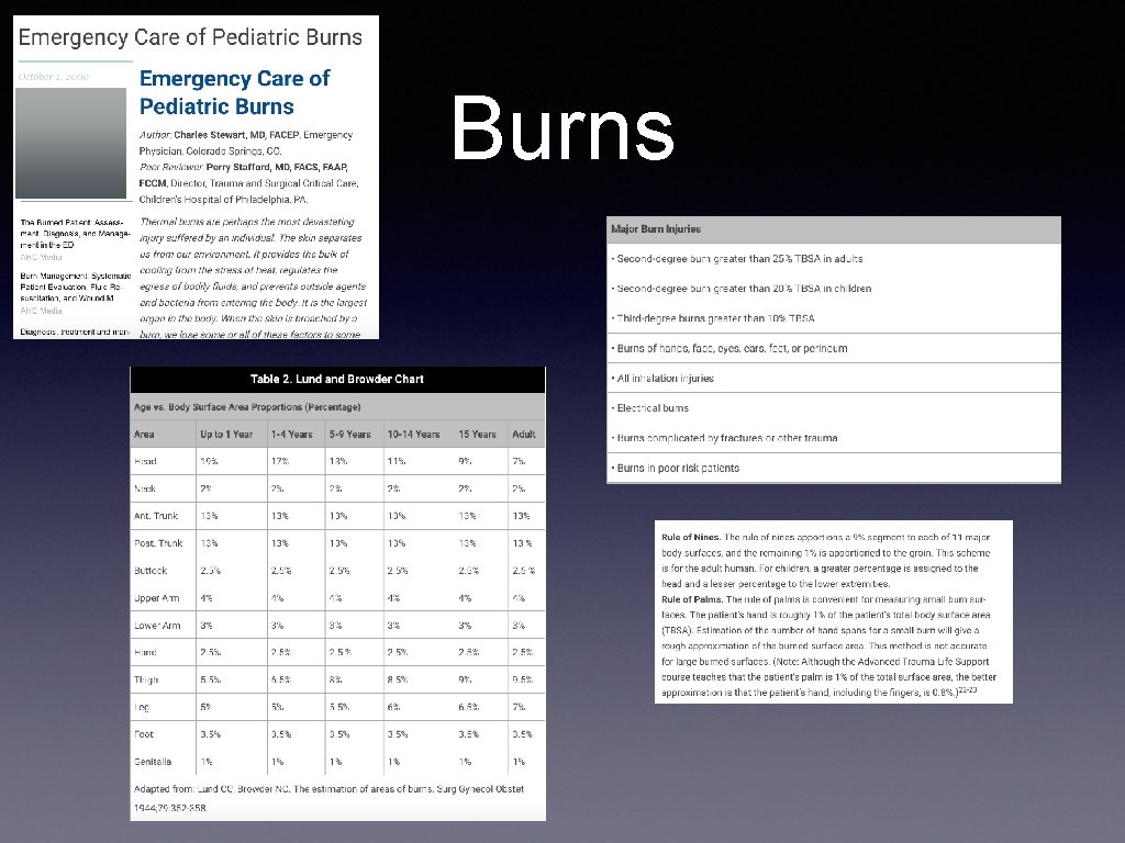 Burns 