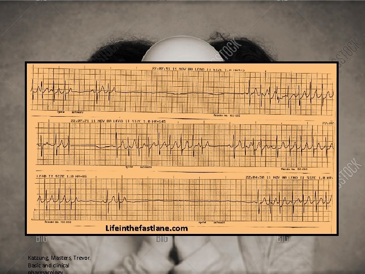 Lifeinthefastlane. com Katzung, Masters, Trevor. Basic and clinical 