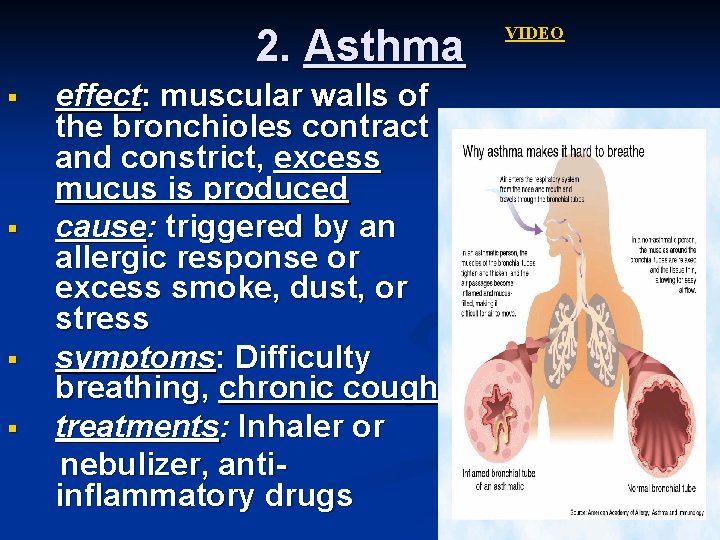 2. Asthma § § effect: muscular walls of the bronchioles contract and constrict, excess