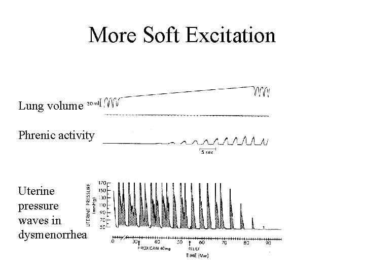 More Soft Excitation Lung volume Phrenic activity Uterine pressure waves in dysmenorrhea 