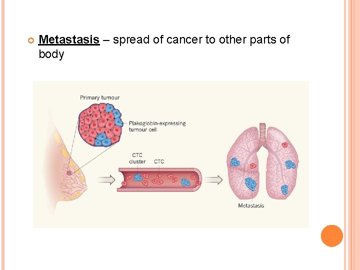  Metastasis – spread of cancer to other parts of body 