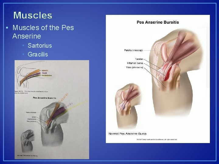 Muscles • Muscles of the Pes Anserine • Sartorius • Gracilis • Semitendinosis 