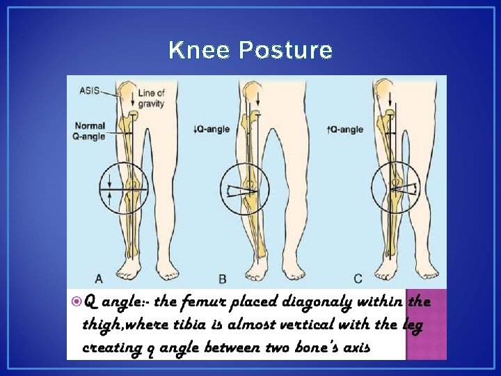 Knee Posture 