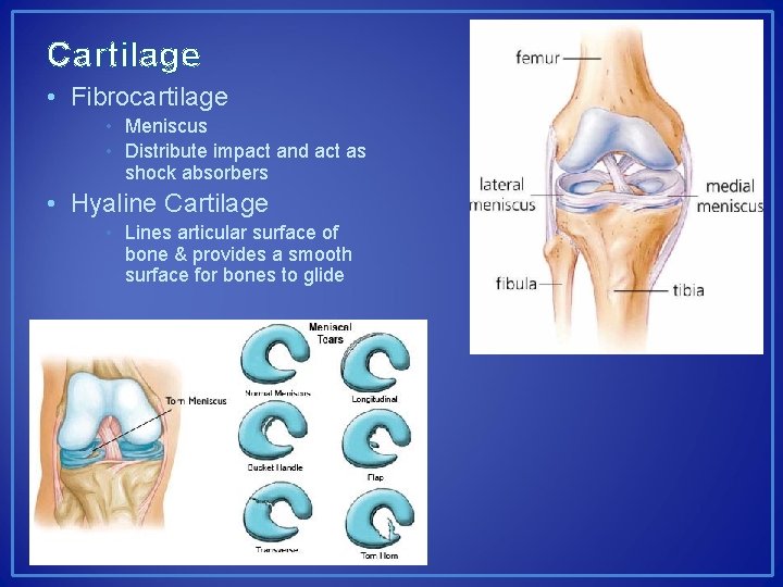 Cartilage • Fibrocartilage • Meniscus • Distribute impact and act as shock absorbers •