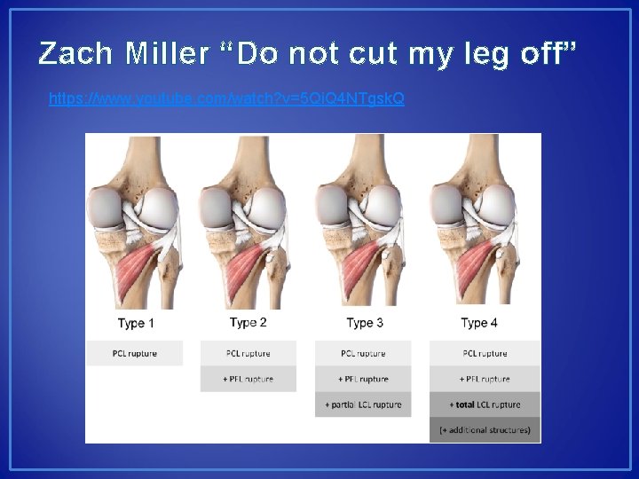 Zach Miller “Do not cut my leg off” https: //www. youtube. com/watch? v=5 Qi.