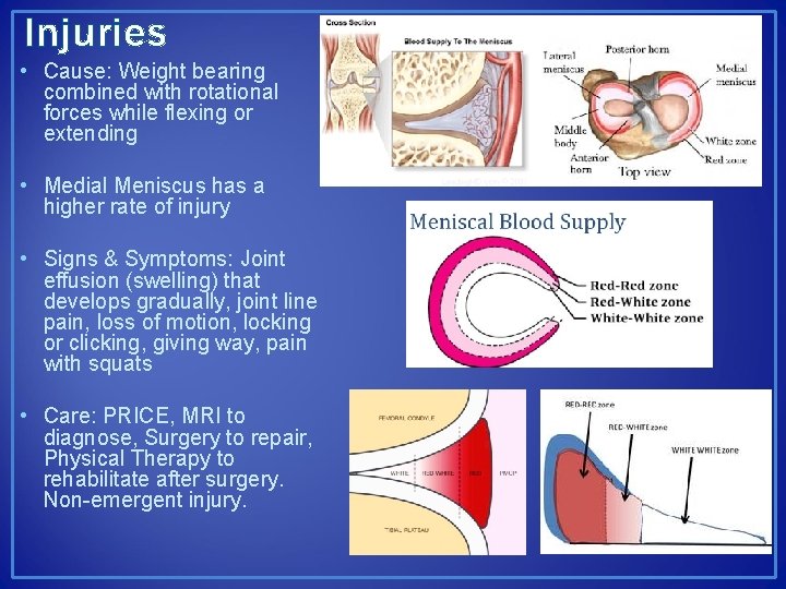 Injuries • Cause: Weight bearing combined with rotational forces while flexing or extending •