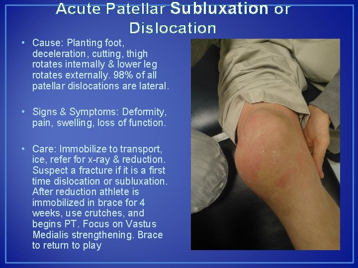 Acute Patellar Subluxation or Dislocation • Cause: Planting foot, deceleration, cutting, thigh rotates internally