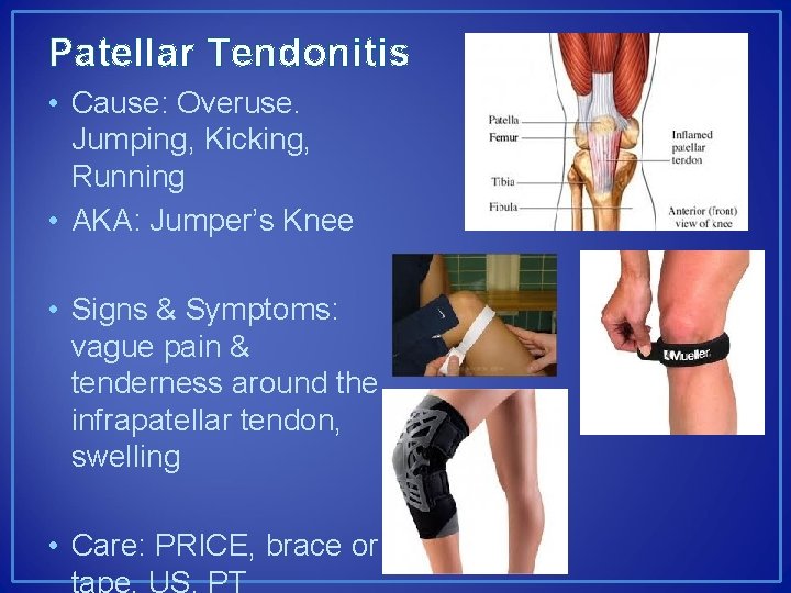 Patellar Tendonitis • Cause: Overuse. Jumping, Kicking, Running • AKA: Jumper’s Knee • Signs