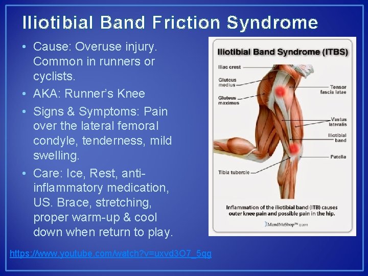 Iliotibial Band Friction Syndrome • Cause: Overuse injury. Common in runners or cyclists. •