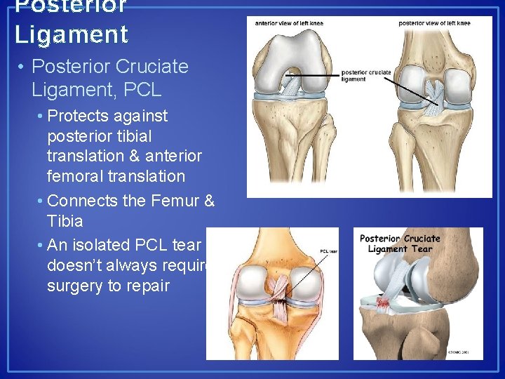 Posterior Ligament • Posterior Cruciate Ligament, PCL • Protects against posterior tibial translation &