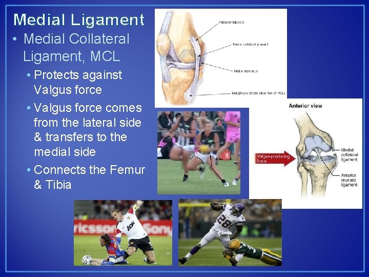 Medial Ligament • Medial Collateral Ligament, MCL • Protects against Valgus force • Valgus