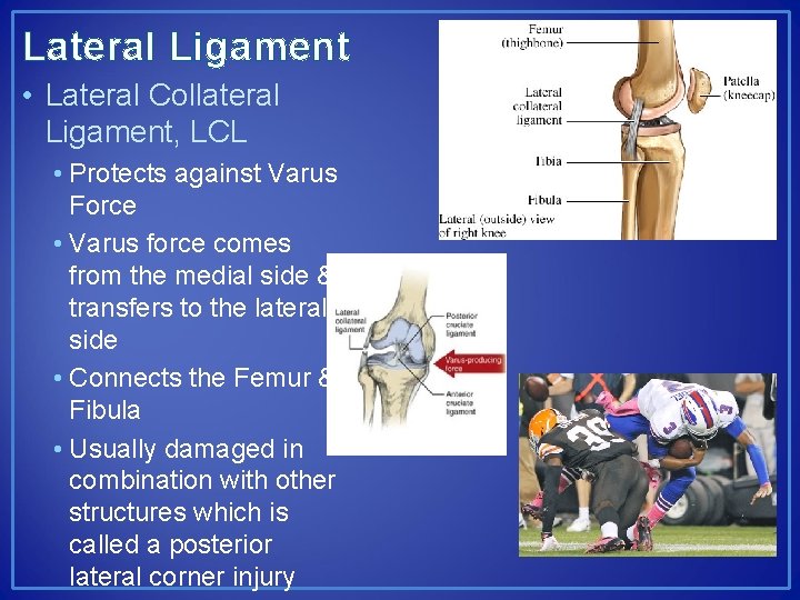 Lateral Ligament • Lateral Collateral Ligament, LCL • Protects against Varus Force • Varus