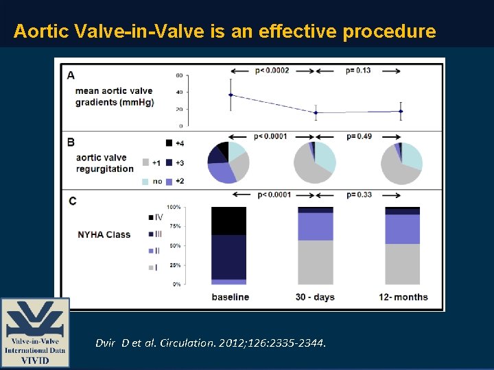 Aortic Valve-in-Valve is an effective procedure Dvir D et al. Circulation. 2012; 126: 2335