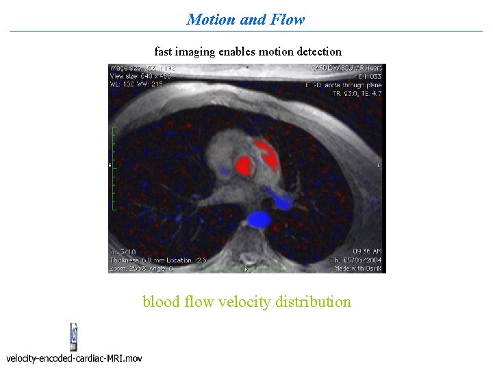 Motion and Flow fast imaging enables motion detection blood flow velocity distribution 