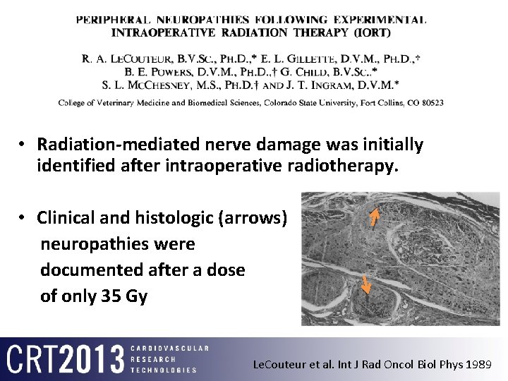  • Radiation-mediated nerve damage was initially identified after intraoperative radiotherapy. • Clinical and