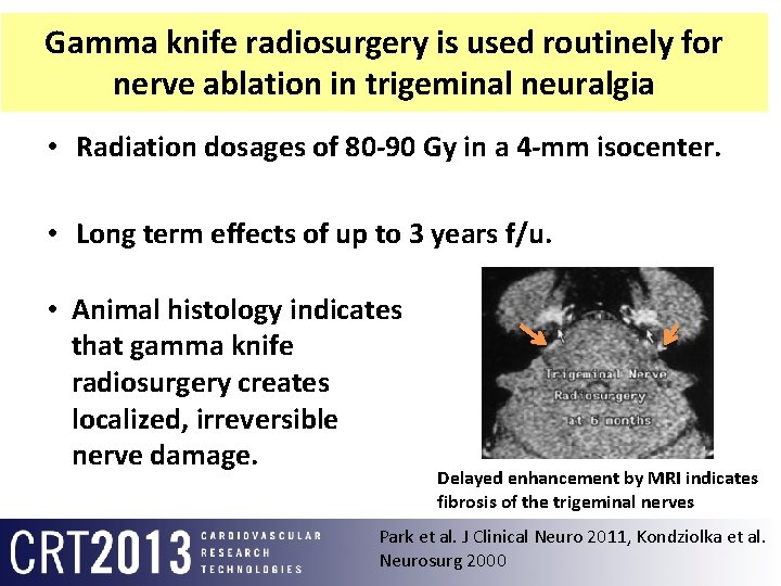Gamma knife radiosurgery is used routinely for nerve ablation in trigeminal neuralgia • Radiation