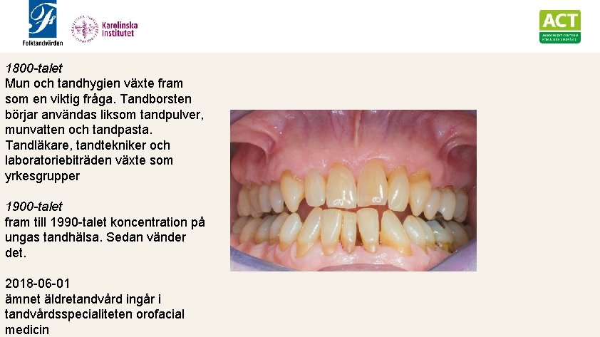 1800 -talet Mun och tandhygien växte fram som en viktig fråga. Tandborsten börjar användas