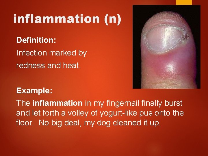 inflammation (n) Definition: Infection marked by redness and heat. Example: The inflammation in my