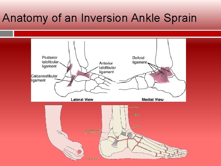 Anatomy of an Inversion Ankle Sprain 