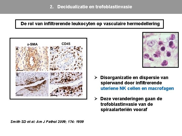2. Decidualizatie en trofoblastinvasie De rol van infiltrerende leukocyten op vasculaire hermodellering Ø Disorganizatie