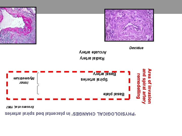 Area of invasion and spiral artery remodelling 2. Decidualizatie en trofoblastinvasie ‘PHYSIOLOGICAL CHANGES’ in