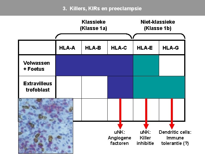 3. Killers, KIRs en preeclampsie Klassieke (Klasse 1 a) HLA-A HLA-B Niet-klassieke (Klasse 1