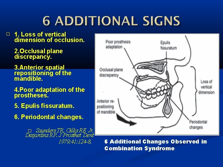 � 1. Loss of vertical dimension of occlusion. 2. Occlusal plane discrepancy. 3. Anterior