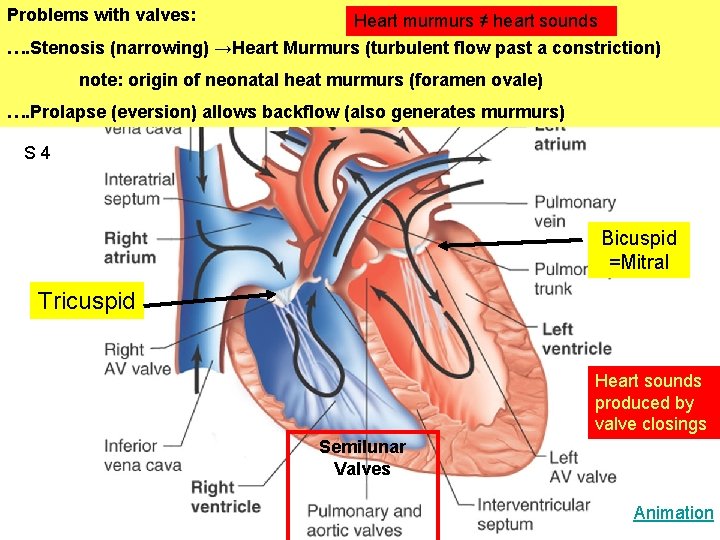 Problems with valves: Heart murmurs ≠ heart sounds …. Stenosis (narrowing) →Heart Murmurs (turbulent