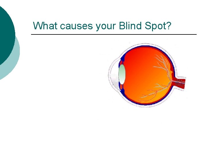 What causes your Blind Spot? 