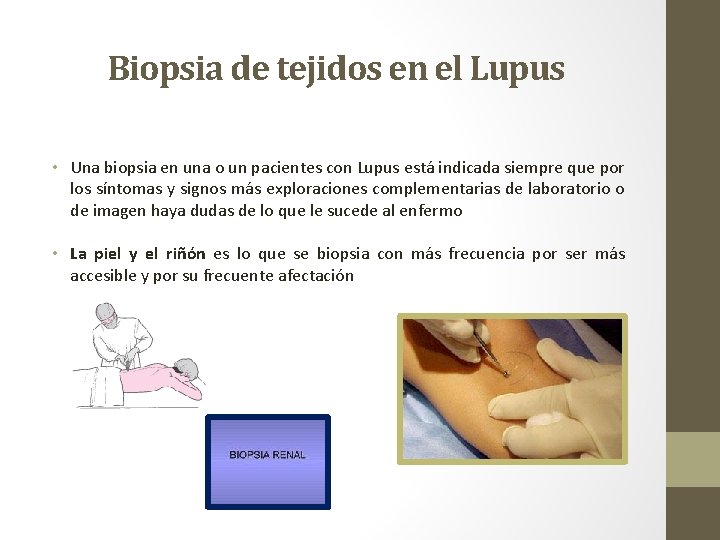 Biopsia de tejidos en el Lupus • Una biopsia en una o un pacientes