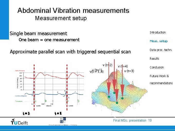 Abdominal Vibration measurements Measurement setup Single beam measurement Introduction One beam = one measurement