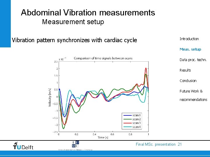 Abdominal Vibration measurements Measurement setup Vibration pattern synchronizes with cardiac cycle Introduction Meas. setup