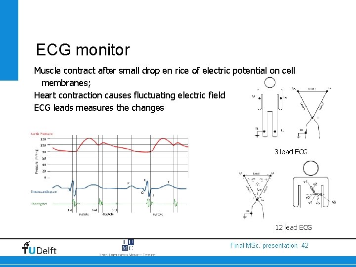 ECG monitor Muscle contract after small drop en rice of electric potential on cell
