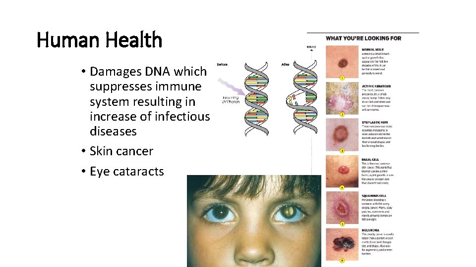 Human Health • Damages DNA which suppresses immune system resulting in increase of infectious
