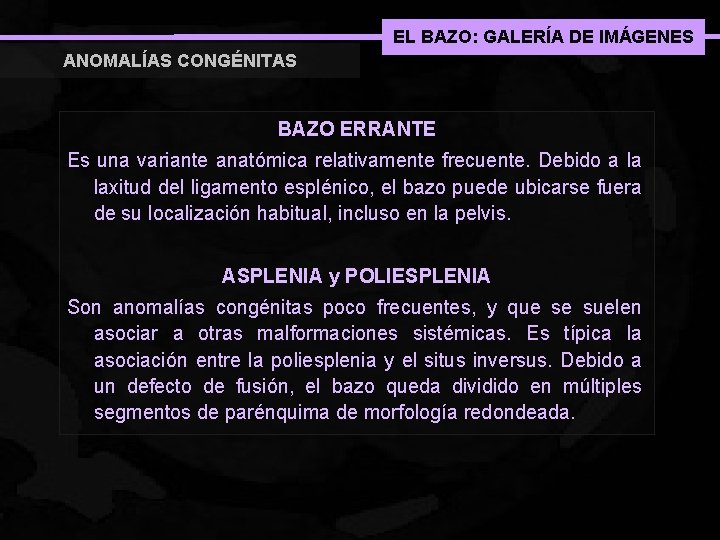 EL BAZO: GALERÍA DE IMÁGENES ANOMALÍAS CONGÉNITAS BAZO ERRANTE Es una variante anatómica relativamente