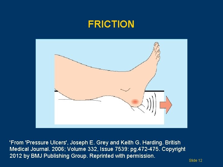 FRICTION 'From 'Pressure Ulcers', Joseph E. Grey and Keith G. Harding. British Medical Journal.