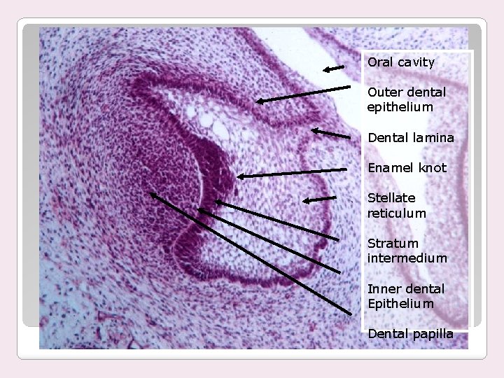 Oral cavity Outer dental epithelium Dental lamina Enamel knot Stellate reticulum Stratum intermedium Inner