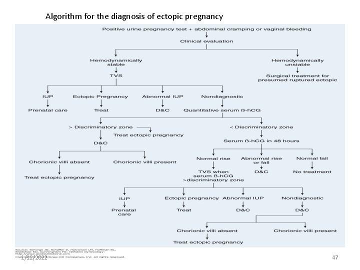 Algorithm for the diagnosis of ectopic pregnancy 1/12/2022 47 