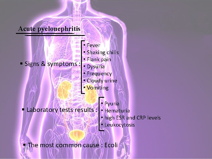 Acute pyelonephritis • Fever • Shaking chills • Flank pain § Signs & symptoms