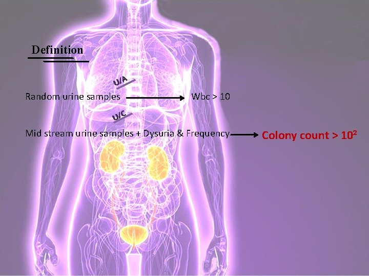 Definition U/A Random urine samples Wbc > 10 U/C Mid stream urine samples +
