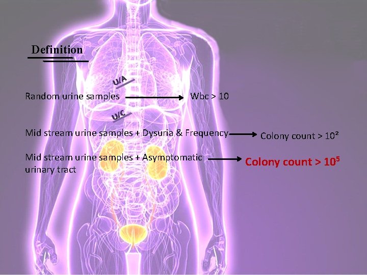 Definition U/A Random urine samples Wbc > 10 U/C Mid stream urine samples +