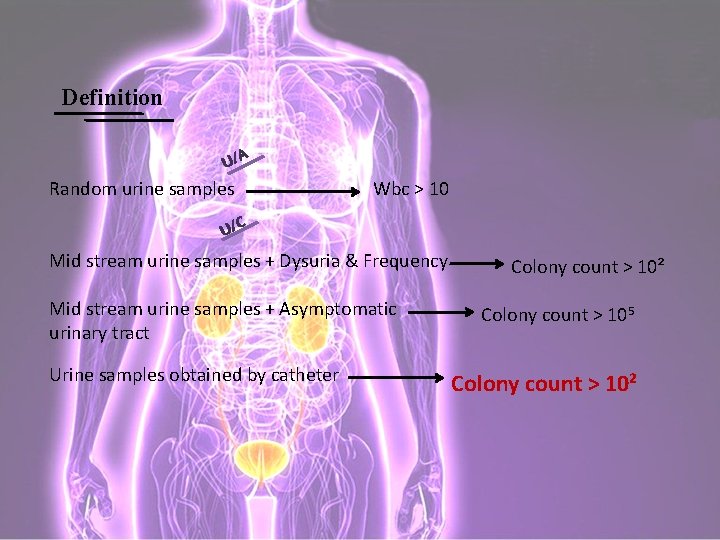 Definition U/A Random urine samples Wbc > 10 U/C Mid stream urine samples +