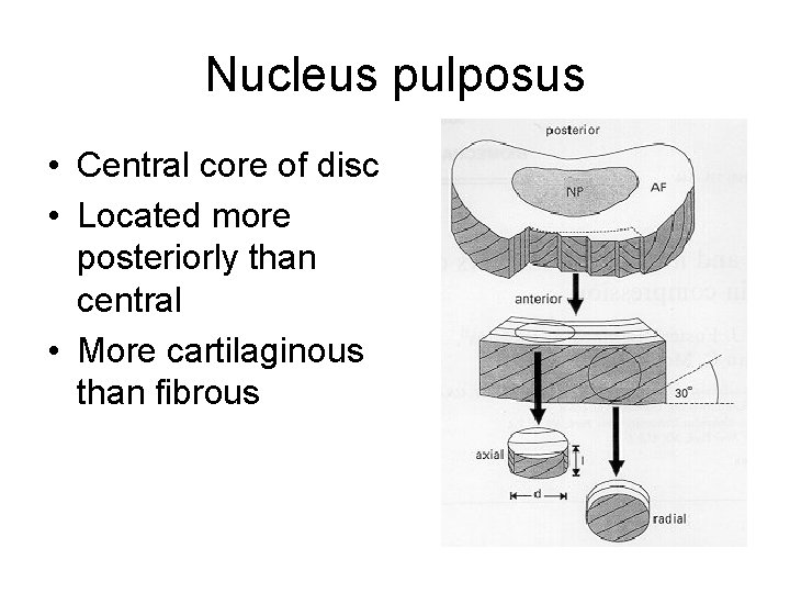 Nucleus pulposus • Central core of disc • Located more posteriorly than central •