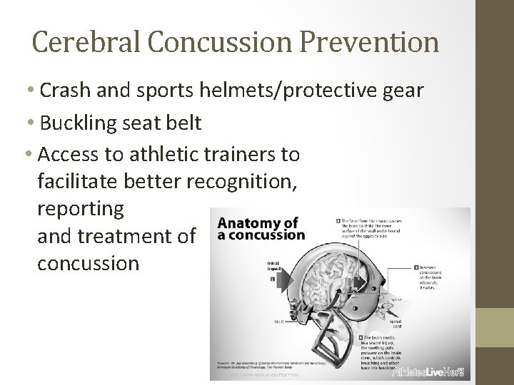 Cerebral Concussion Prevention • Crash and sports helmets/protective gear • Buckling seat belt •