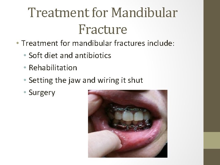 Treatment for Mandibular Fracture • Treatment for mandibular fractures include: • Soft diet and