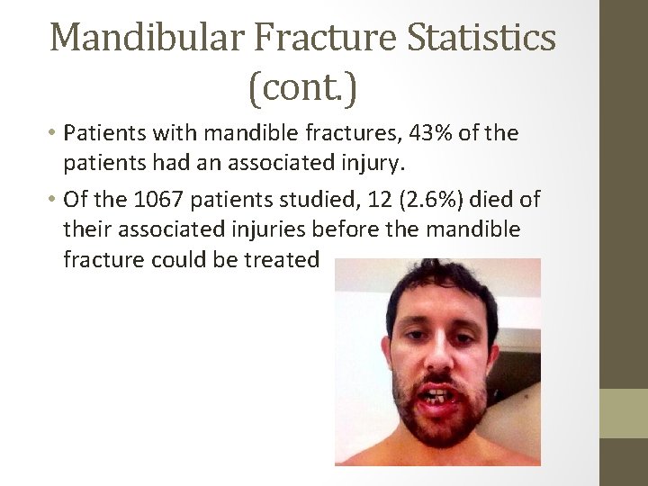 Mandibular Fracture Statistics (cont. ) • Patients with mandible fractures, 43% of the patients