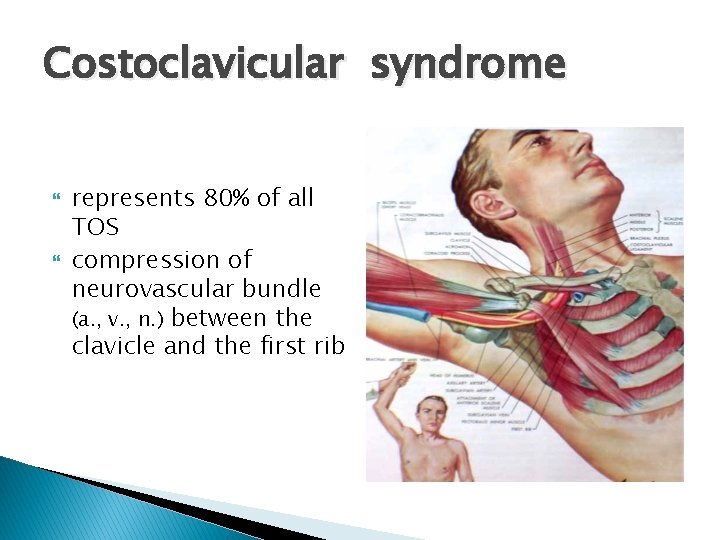Costoclavicular syndrome represents 80% of all TOS compression of neurovascular bundle (a. , v.