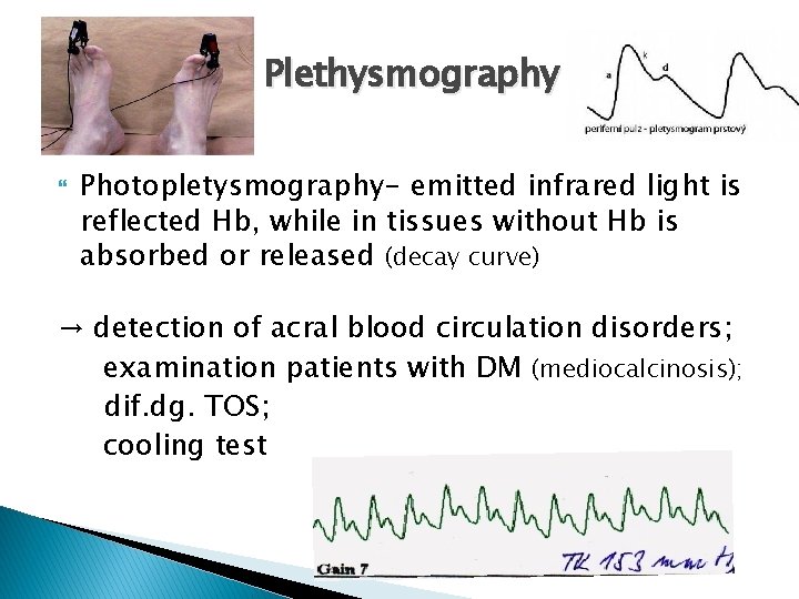 Plethysmography Photopletysmography- emitted infrared light is reflected Hb, while in tissues without Hb is